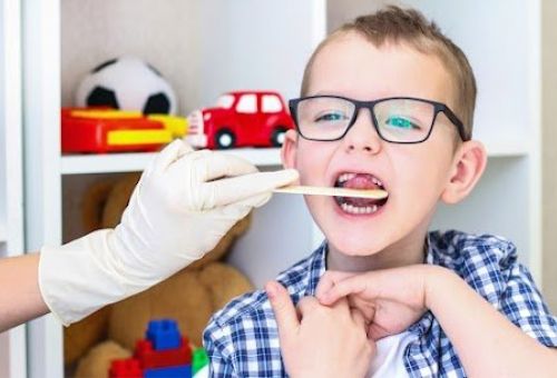 Trastorno habla Trastorno habla